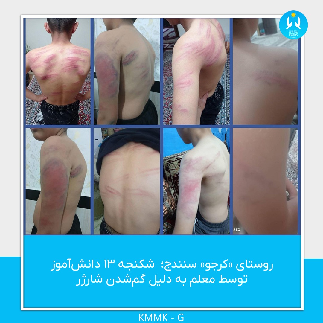 روستای «کرجو» سنندج؛  شکنجه‌ ۱۳ دانش‌آموز توسط معلم به ‌دلیل گم‌شدن شارژر 

روز یکشنبه ۲۴ فروردین ۱۴۰۴، یک معلم به‌ دلیل گم‌شدن شارژر تلفن همراه خود،١۳ دانش‌آموز پسر کلاس پنجم را در مدرسه‌ ابتدایی «قلم‌چی» در روستای «کرجو» از توابع سنندج مورد شکنجه و آزار جسمی قرار داد. این معلم