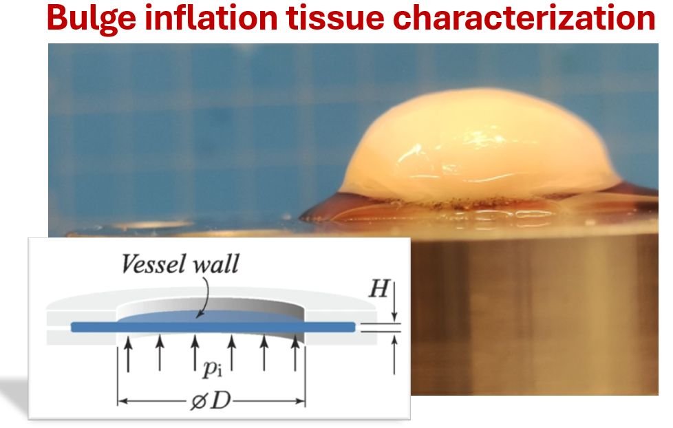 gasserKTH (@gasserkth) on Twitter photo ๐๐ฎ๐ฅ๐๐ ๐ ๐๐ง๐๐ฅ๐๐ญ๐ข๐จ๐ง of the vascular wall is one hands-on laboratory task at ๐๐ง๐ ๐ฆ๐๐บ๐บ๐ฒ๐ฟ ๐๐ฐ๐ต๐ผ๐ผ๐น: ๐๐ผ๐บ๐ฝ๐๐๐ฎ๐๐ถ๐ผ๐ป๐ฎ๐น ๐ง๐ถ๐๐๐๐ฒ ๐๐ถ๐ผ๐บ๐ฒ๐ฐ๐ต๐ฎ๐ป๐ถ๐ฐ๐. Students learn how to perform and analyze the data.
docs.google.com/forms/d/e/1FAIโฆ ๐๐ฎ๐ฅ๐๐ ๐ ๐๐ง๐๐ฅ๐๐ญ๐ข๐จ๐ง of the vascular wall is one hands-on laboratory task at ๐๐ง๐ ๐ฆ๐๐บ๐บ๐ฒ๐ฟ ๐๐ฐ๐ต๐ผ๐ผ๐น: ๐๐ผ๐บ๐ฝ๐๐๐ฎ๐๐ถ๐ผ๐ป๐ฎ๐น ๐ง๐ถ๐๐๐๐ฒ ๐๐ถ๐ผ๐บ๐ฒ๐ฐ๐ต๐ฎ๐ป๐ถ๐ฐ๐. Students learn how to perform and analyze the data.
docs.google.com/forms/d/e/1FAIโฆ