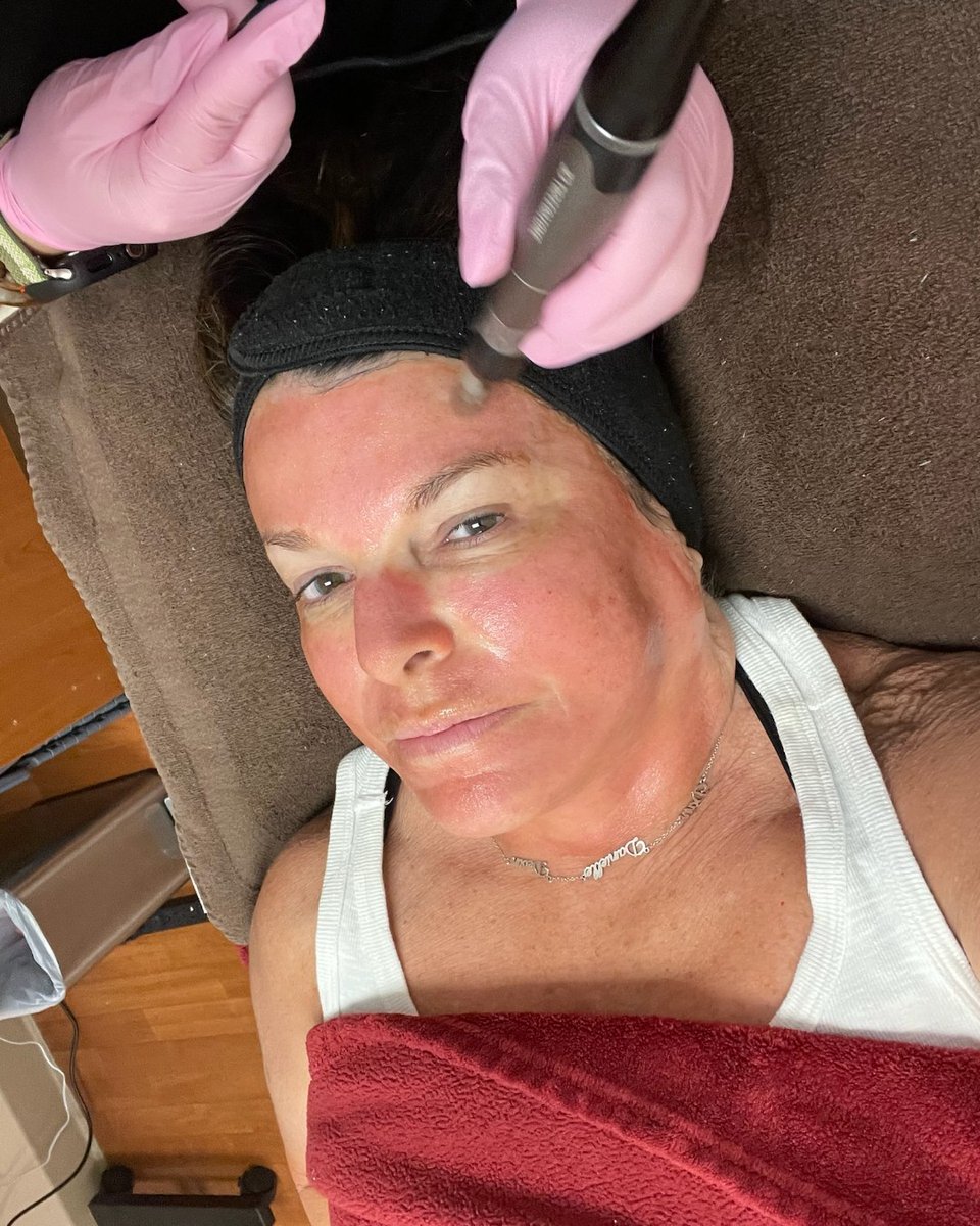 LaserVein's tweet image. 🌟 Glow All Year with Our Preferred Patient Program! 🌟

Get personalized monthly skin analyses and expert treatments from our skilled aestheticians! 🧖‍♀️✨ Your skin deserves the best—let’s create a routine just for you.

Call 636-614-1665 to learn more!

#PreferredPatientProgram