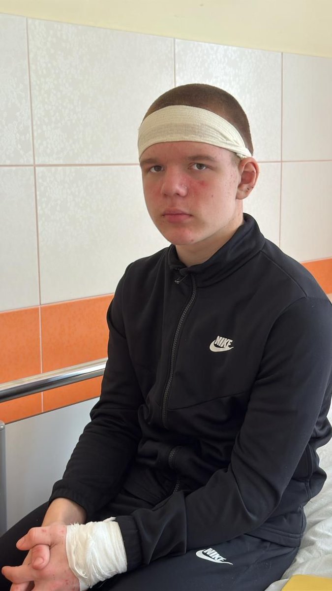 United24media's tweet photo. ⚡️ 13-year-old Kyrylo, who helped passengers escape a burning bus after Russia’s missile strike on Sumy, ended up saving relatives of his classmates, Hromadske reports.

Doctors removed a metal fragment from his head; two more may stay in his skull for life. His mom was also injured.