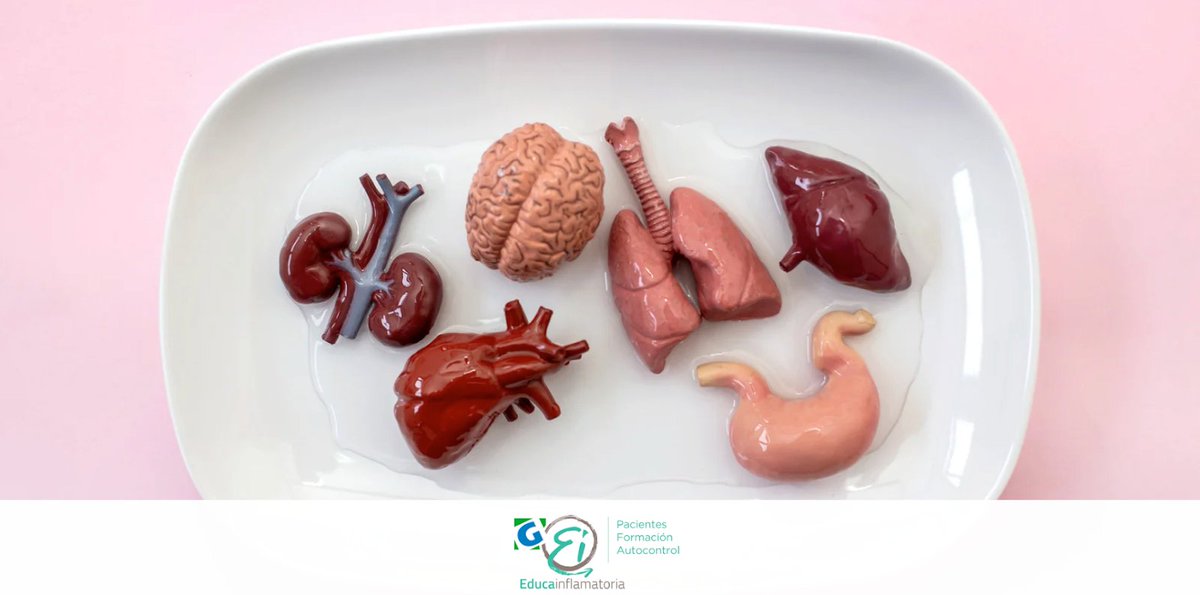 La enfermedad inflamatoria intestinal no se limita al intestino: también puede afectar piel, ojos y articulaciones. 

Descubre en nuestra web una guía completa sobre estas manifestaciones extraintestinales y cómo gestionarlas mejor ➡️ educainflamatoria.com/category/manif…