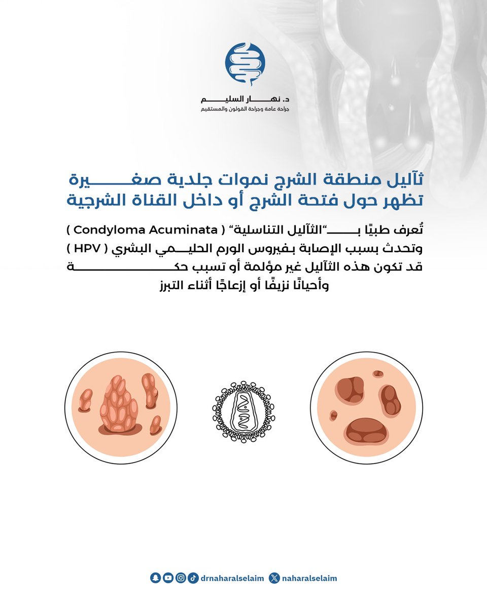 "ثآليل منطقة الشرج"

د.نهار السليم 
جراحة عامة وجراحة القولون والمستقيم 
للتنسيق والاستفسار: 0553983723
الموقع : مستشفى دلة النخيل- الرياض 

#الطب #الرياض #الشرج #جلدية #تناسلية #جراحة #جراحة_عامة #قولون #المستقيم