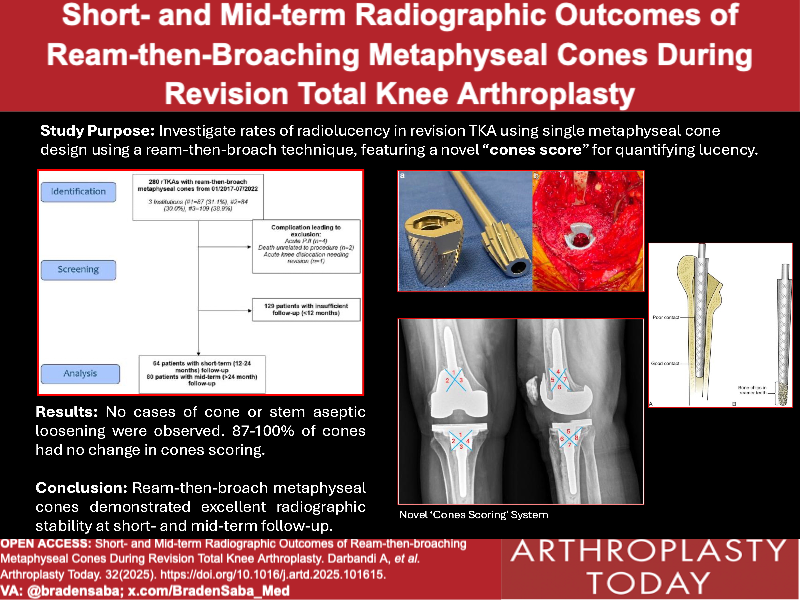 A stable CONE-STRUCT for revision TKA

What are your tips for success with cones? <a href="/jointdocShields/">John Shields, MD, FAAOS</a> <a href="/RexLutzDO/">Rex Lutz, DO</a> <a href="/C_Sangio/">Christian A. Sangio, MD</a> 

Visual Abstract: @bradensaba

arthroplastytoday.org/action/showPdf…