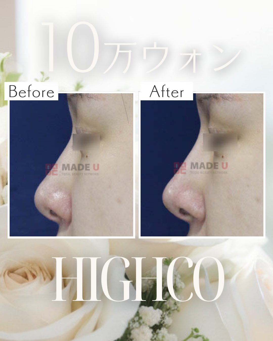 メイドユー医院🏥メシダダイエット | 4月から新登場したメシダ