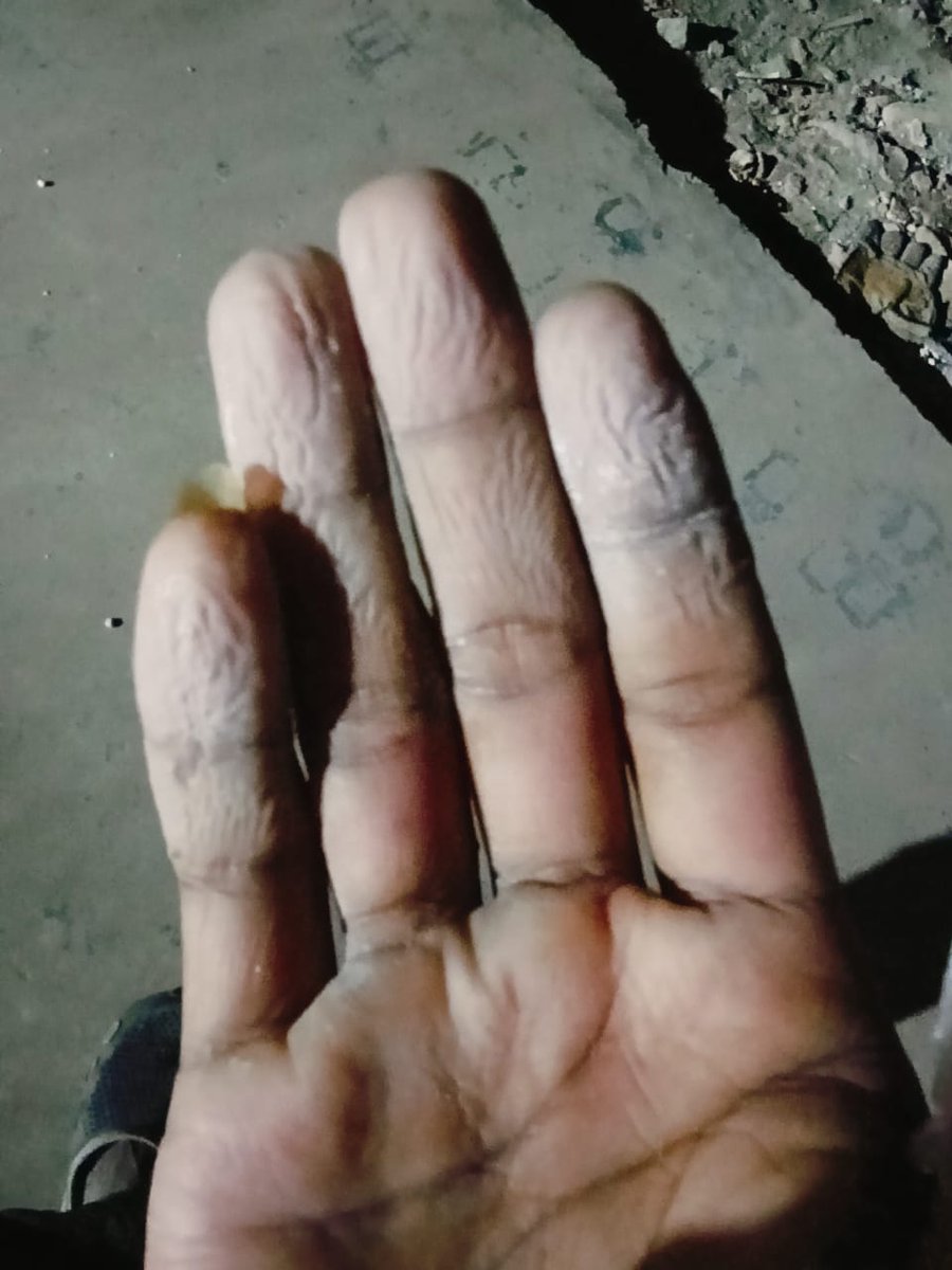 sameerkumarb74's tweet photo. With great grief, it is to inform reg. the inhuman and illegal trap of people of Baliposi, Mayurbhanj, Odisha. As requested by the villagers of Baliposi under Thakurmunda police station of Mayurbhanj,I m herewith attaching d complaint letter along with supporting docs for rescue. https://t.co/EufalJ5VHm
