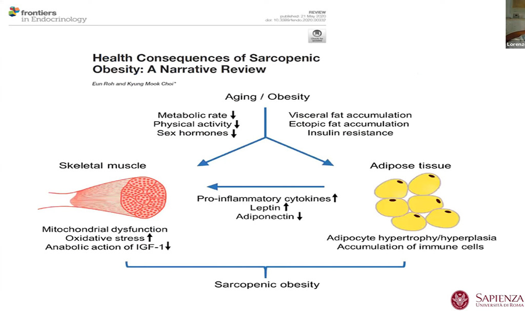 Webinar recording now available on Sarcopenic Obesity 

This COMs webinar provides an overview of the EASO/ @ESPEN_org Guidelines for Diagnosis of Sarcopenic Obesity + knowledge on sarcopenic obesity development across life stages

easo.org/video/sarcopen…
#Obesity