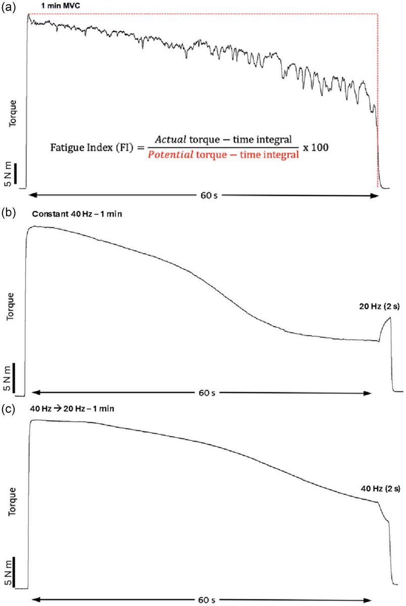 Experimental Physiology (@expphysiol) on Twitter photo Raaj Dudani, <a href="/Alex_M_Zero/">Alexander Zero</a> and Charles L. Rice (<a href="/westernuFHS/">Western Health Sciences</a>) look to resolve the discrepancy between studies using electrical stimulation to evaluate the ‘muscular wisdom’ hypothesis!
📜buff.ly/kkS2YPu Raaj Dudani, <a href="/Alex_M_Zero/">Alexander Zero</a> and Charles L. Rice (<a href="/westernuFHS/">Western Health Sciences</a>) look to resolve the discrepancy between studies using electrical stimulation to evaluate the ‘muscular wisdom’ hypothesis!
📜buff.ly/kkS2YPu