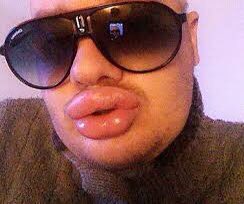 🎗Bilgin (@elmayiyorum) on Twitter photo 