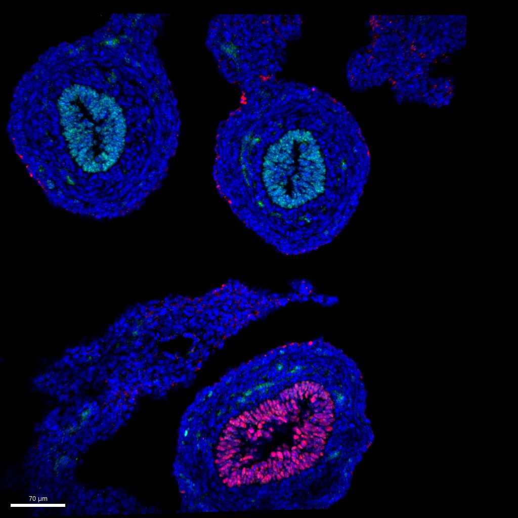 e14.5 mouse intestine stained for GATA4 (green) SATB2 (red) and DAPI (blue). #microscopymonday #sciart #bioart #sesdb2025