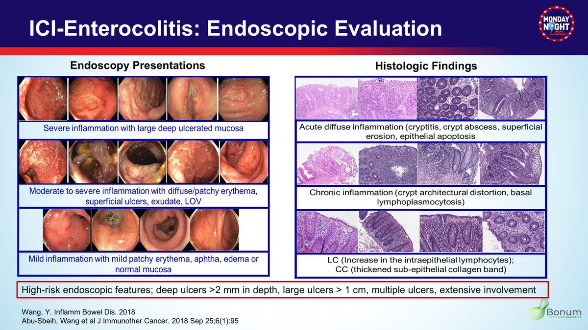 Mazen Almasry, MD (@mazenalmasry4) on Twitter photo <a href="/MondayNightIBD/">#MondayNightIBD</a> <a href="/bbuchbinderMD/">elizabeth buchbinder</a> <a href="/ChaftJamie/">Jamie Chaft</a> <a href="/gregfischer72/">GREGORY W FISCHER, MD</a> <a href="/margare89055458/">margaret barton-burke</a> <a href="/MyriamChalabi/">Myriam Chalabi</a> <a href="/GeneCollector/">Timothy Chan</a> <a href="/drkeithsiau/">Keith Siau</a> <a href="/ArndtVogel/">Arndt Vogel</a> <a href="/RyanNipp/">Ryan Nipp, MD, MPH, MBA, FASCO</a> <a href="/CarlKayMD/">Carl Kay, MD</a> <a href="/realDoctorUgo/">Ugo Iroku MD</a> <a href="/AmirGhaffariMD/">Amir Ghaffari</a> <a href="/AmyBugwadia/">Amy Bugwadia, MS</a> <a href="/Gastrolegacy1/">Gastrolegacy</a> <a href="/TheGastrologer/">Muddasir Ayaz</a> <a href="/RestelliniS/">Sophie Restellini</a> <a href="/MbarbaraMD/">Mary Barbara</a> <a href="/GlassnerKerri/">Kerri Glassner</a> <a href="/sang_hyoung/">Sang Hyoung Park</a> <a href="/MLutzMD/">Megan Lutz</a> <a href="/KralJan/">Jan Král</a> <a href="/NabilQuraishi/">Nabil Quraishi</a> <a href="/RashidLui/">Rashid Lui 雷諾信</a> <a href="/JVG_GIMD/">Javier A. Villafuerte Gálvez</a> <a href="/h_sokol/">Harry Sokol</a> <a href="/evanlipson/">Evan Lipson</a> <a href="/DeepakGIQuality/">Deepak Gopal</a> <a href="/Ryansmith_MD/">Ryan Smith</a> <a href="/JPAchkarMD/">Jean-Paul Achkar</a> <a href="/Ari_G_MD/">Ari Garber MD, EdD</a> <a href="/IBDimmunology/">Shrinivas Bishu</a> <a href="/ReezwanaCMD/">Reezwana C, MD, FACG</a> <a href="/DhereMdEmory/">Tanvi Dhere,MD</a> <a href="/waqqasafif/">Waqqas Afif, MD</a> <a href="/BattatMD4IBD/">Robert Battat MD</a> <a href="/ibdgijami/">Jami Kinnucan, MD, FACG, AGAF, FCCF</a> <a href="/nloganmd/">Nisha Loganantharaj</a> <a href="/ibdseb/">Seb</a> <a href="/GI_JeffMD/">Jeffrey McCurdy MD PhD</a> <a href="/KajaliMishra/">Kajali Mishra</a> <a href="/DrVinnyCheung/">Vincent Cheung</a> <a href="/AndrewProthero6/">Andrew Protheroe</a> <a href="/PKlenermanLab/">PaulKlenermanLab</a> <a href="/sarah_sasson/">𝚂𝚊𝚛𝚊𝚑 𝚂𝚊𝚜𝚜𝚘𝚗</a> <a href="/KBollinMD/">Kathryn Bollin</a> <a href="/FunchainMD/">Pauline Funchain</a> <a href="/DrJNaidoo/">Jarushka Naidoo</a> <a href="/dr_kbrass/">Kelly (Faltus) Brassil, PhD, RN</a> <a href="/ibdtweets/">Tauseef Ali MD, FACG AGAF FACP</a> 7/ Endoscopic🔦findings in ICI colitis range from normal to IBD-like
🔬Histo: destructive pattern w crypt/epithelial apoptosis; acute/chronic inflam, cryptitis & crypt architecture distortion
📌Can mimic microscopic colitis or celiac
⚠️Always biopsy—even if mucosa looks normal <a href="/MondayNightIBD/">#MondayNightIBD</a> <a href="/bbuchbinderMD/">elizabeth buchbinder</a> <a href="/ChaftJamie/">Jamie Chaft</a> <a href="/gregfischer72/">GREGORY W FISCHER, MD</a> <a href="/margare89055458/">margaret barton-burke</a> <a href="/MyriamChalabi/">Myriam Chalabi</a> <a href="/GeneCollector/">Timothy Chan</a> <a href="/drkeithsiau/">Keith Siau</a> <a href="/ArndtVogel/">Arndt Vogel</a> <a href="/RyanNipp/">Ryan Nipp, MD, MPH, MBA, FASCO</a> <a href="/CarlKayMD/">Carl Kay, MD</a> <a href="/realDoctorUgo/">Ugo Iroku MD</a> <a href="/AmirGhaffariMD/">Amir Ghaffari</a> <a href="/AmyBugwadia/">Amy Bugwadia, MS</a> <a href="/Gastrolegacy1/">Gastrolegacy</a> <a href="/TheGastrologer/">Muddasir Ayaz</a> <a href="/RestelliniS/">Sophie Restellini</a> <a href="/MbarbaraMD/">Mary Barbara</a> <a href="/GlassnerKerri/">Kerri Glassner</a> <a href="/sang_hyoung/">Sang Hyoung Park</a> <a href="/MLutzMD/">Megan Lutz</a> <a href="/KralJan/">Jan Král</a> <a href="/NabilQuraishi/">Nabil Quraishi</a> <a href="/RashidLui/">Rashid Lui 雷諾信</a> <a href="/JVG_GIMD/">Javier A. Villafuerte Gálvez</a> <a href="/h_sokol/">Harry Sokol</a> <a href="/evanlipson/">Evan Lipson</a> <a href="/DeepakGIQuality/">Deepak Gopal</a> <a href="/Ryansmith_MD/">Ryan Smith</a> <a href="/JPAchkarMD/">Jean-Paul Achkar</a> <a href="/Ari_G_MD/">Ari Garber MD, EdD</a> <a href="/IBDimmunology/">Shrinivas Bishu</a> <a href="/ReezwanaCMD/">Reezwana C, MD, FACG</a> <a href="/DhereMdEmory/">Tanvi Dhere,MD</a> <a href="/waqqasafif/">Waqqas Afif, MD</a> <a href="/BattatMD4IBD/">Robert Battat MD</a> <a href="/ibdgijami/">Jami Kinnucan, MD, FACG, AGAF, FCCF</a> <a href="/nloganmd/">Nisha Loganantharaj</a> <a href="/ibdseb/">Seb</a> <a href="/GI_JeffMD/">Jeffrey McCurdy MD PhD</a> <a href="/KajaliMishra/">Kajali Mishra</a> <a href="/DrVinnyCheung/">Vincent Cheung</a> <a href="/AndrewProthero6/">Andrew Protheroe</a> <a href="/PKlenermanLab/">PaulKlenermanLab</a> <a href="/sarah_sasson/">𝚂𝚊𝚛𝚊𝚑 𝚂𝚊𝚜𝚜𝚘𝚗</a> <a href="/KBollinMD/">Kathryn Bollin</a> <a href="/FunchainMD/">Pauline Funchain</a> <a href="/DrJNaidoo/">Jarushka Naidoo</a> <a href="/dr_kbrass/">Kelly (Faltus) Brassil, PhD, RN</a> <a href="/ibdtweets/">Tauseef Ali MD, FACG AGAF FACP</a> 7/ Endoscopic🔦findings in ICI colitis range from normal to IBD-like
🔬Histo: destructive pattern w crypt/epithelial apoptosis; acute/chronic inflam, cryptitis & crypt architecture distortion
📌Can mimic microscopic colitis or celiac
⚠️Always biopsy—even if mucosa looks normal