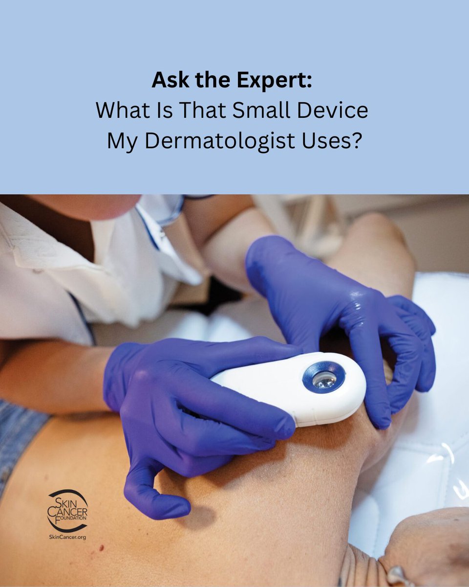 Ever wonder what that small device your dermatologist uses is? 
That device is a specialized handheld magnifier called a dermatoscope. 
This tool magnifies the skin 10 times larger than what you can see with the naked eye. skincancer.org/blog/ask-the-e…