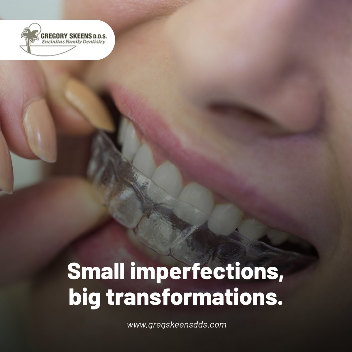 Small imperfections, big transformations. Our dental bonding services are a simple, effective way to perfect your smile, making you feel comfortable and confident with every laugh.

 #tooth #dentalclinic #cosmeticdentistry