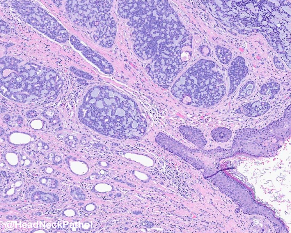 Head Neck Pathol tweet media