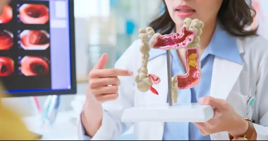 Worried about colonoscopy prep? You're not alone. Dr. Ankur Parikh, explains how to prepare for a colonoscopy — including what to eat, what to avoid, and what to expect the day of your procedure. bit.ly/4lsPvU2
