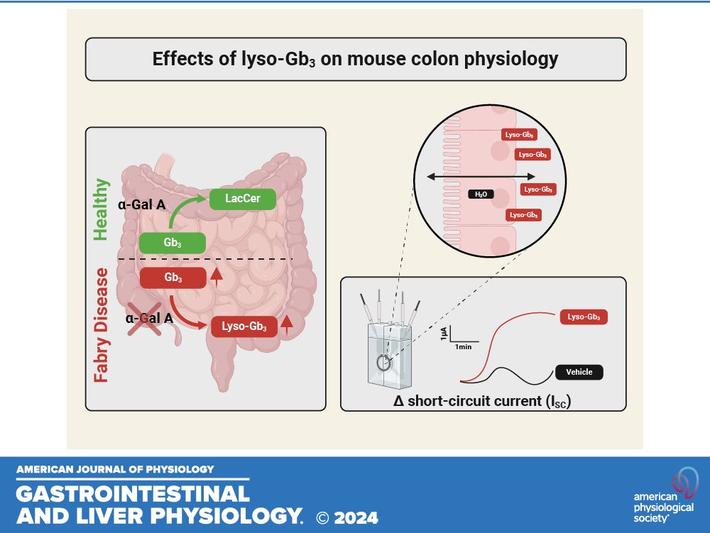 AJP-Gastrointestinal and Liver Physiology (@ajpgi) on Twitter photo 🎙️ New Podcast Alert! Dive into Fabry disease with coauthors <a href="/CeciliaDelpret1/">Cecilia Delprete</a>, <a href="/fuhlig273/">Friederike Uhlig</a>, Caprini & <a href="/niall_hyland/">Niall P Hyland</a>. Discover how lyso-Gb3 impacts #GutHealth!
🎧ow.ly/fe7N50VAlm9
#FabryDisease #biomarker #UssingChamber <a href="/Pharmabiotic/">APC Microbiome Ireland</a> <a href="/UCC/">UCC Ireland</a> 🎙️ New Podcast Alert! Dive into Fabry disease with coauthors <a href="/CeciliaDelpret1/">Cecilia Delprete</a>, <a href="/fuhlig273/">Friederike Uhlig</a>, Caprini & <a href="/niall_hyland/">Niall P Hyland</a>. Discover how lyso-Gb3 impacts #GutHealth!
🎧ow.ly/fe7N50VAlm9
#FabryDisease #biomarker #UssingChamber <a href="/Pharmabiotic/">APC Microbiome Ireland</a> <a href="/UCC/">UCC Ireland</a>