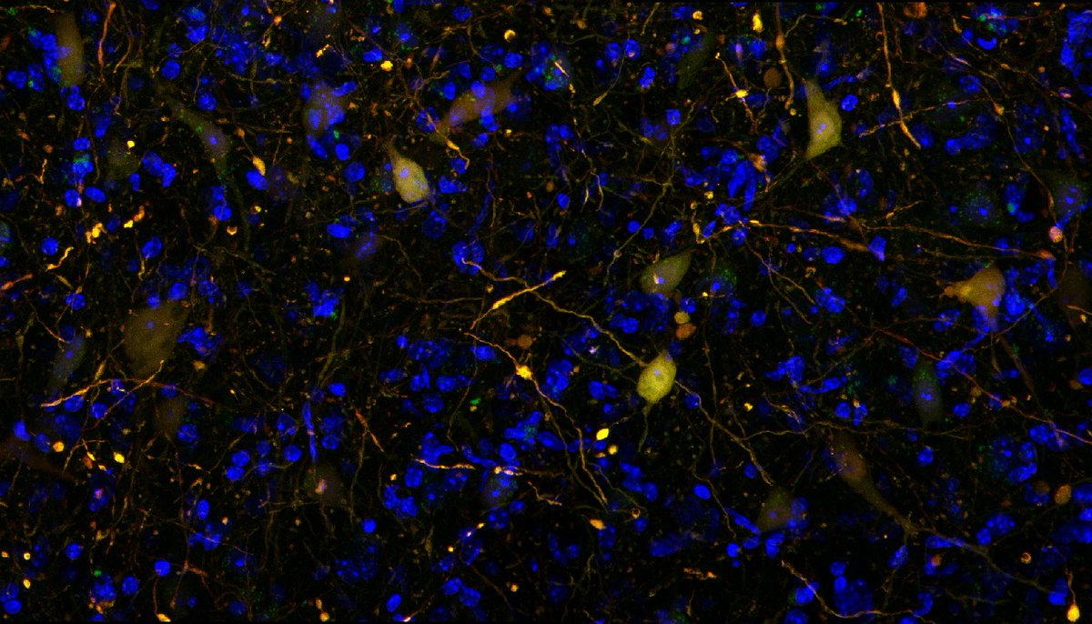 Too beautiful to wait for #FluorescenceFriday. #MicroscopyMonday. We got PV-iGABASnfr (green) overlapping with Flex-TdTomato virus in PV-Cre mice!