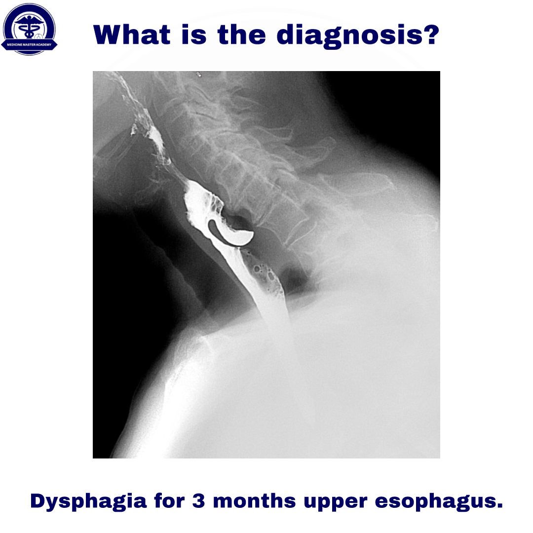 You are welcome to participate 😉

#usmle #medicine #meded #medicaleducation #UsmleSTEP1 #usmlestep2ck #gastro #gastroenterology #medicinemasteracademy #diagnosis #dysphagia