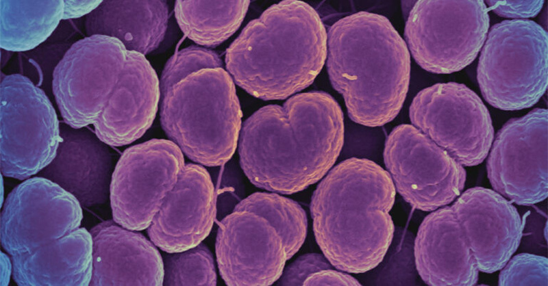 statnews's tweet photo. The CDC’s top sexually transmitted disease lab has been shut down by the Trump administration. The lab focused on monitoring drug resistance in bacteria that cause these infections.
