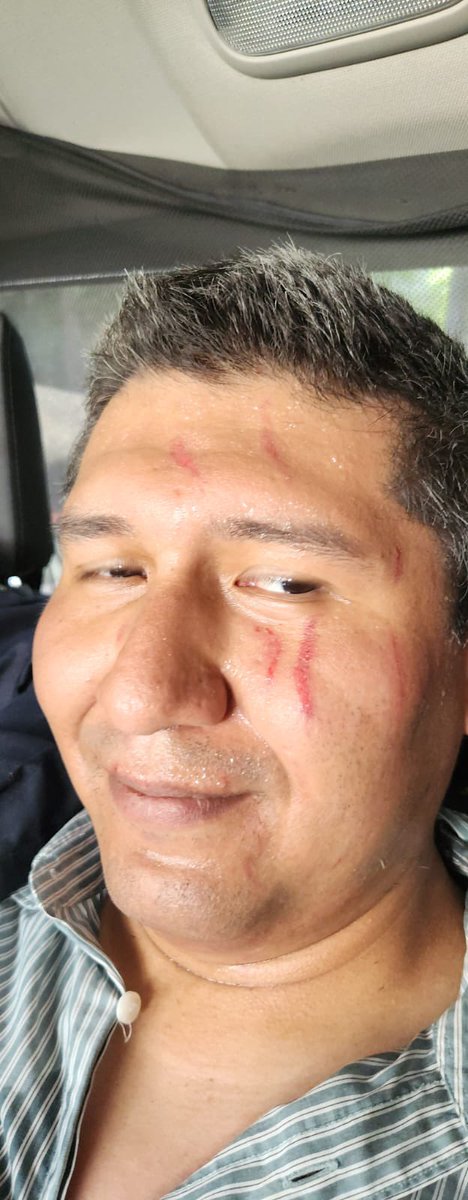 amarilloalarcon's tweet photo. 🔴 #Enterste
Necropsia: Traumatismo craneoencefálico, causa de muerte de femincida serial de #Iztacalco: autoridades de @FiscaliaCDMX
Informaron que el golpe en la cabeza y su complicación
fue
la causa de muerte de Miguel Cortés Miranda
Dictamen integrado a la #CI https://t.co/8cUe03DdNf