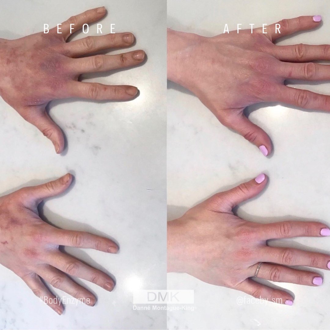 💚 DMK International | Professional Skincare 💚 tweet media