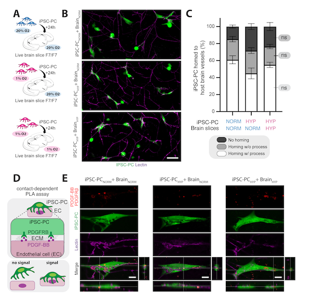 rust_ruslan's tweet photo. Pericytes could help restore the blood-brain barrier in stroke &amp; Alzheimer’s. 

But there’s a catch:
They’ve only been studied under normal oxygen (normoxia).  So, can they function in low-oxygen (hypoxic) conditions seen in these diseases? 

Our preprint: https://t.co/dCo7Qmohtw https://t.co/YJSZkRlphh