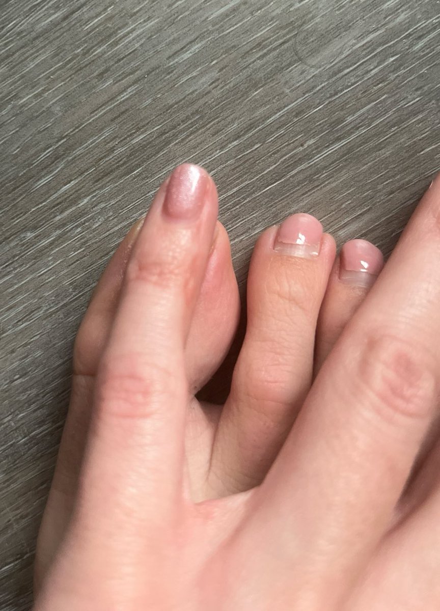 GoddessLexiRay's tweet photo. Is it normal to have a second toe as long as your pinky finger?😵‍💫

if you’re into long toes in feet pics you know how to get my attention💰 https://t.co/BLTJ6kEKtn