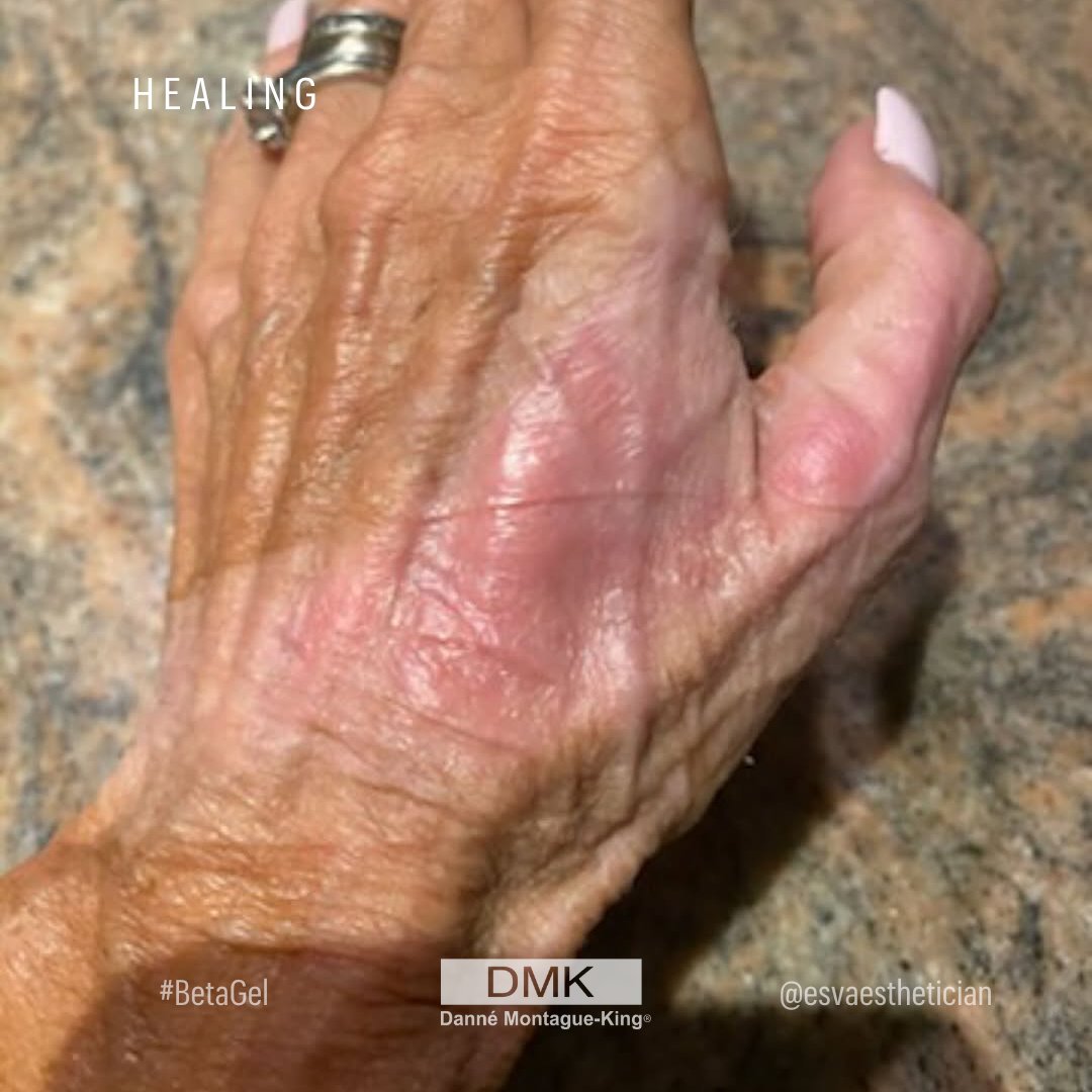 💚 DMK International | Professional Skincare 💚 tweet media