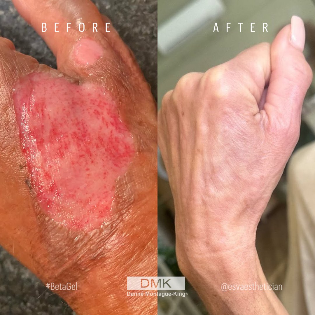 💚 DMK International | Professional Skincare 💚 tweet media