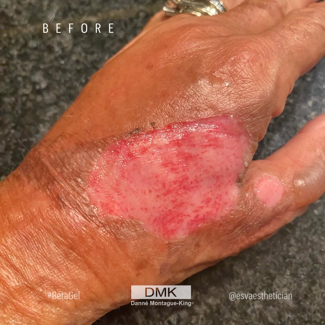 💚 DMK International | Professional Skincare 💚 tweet media