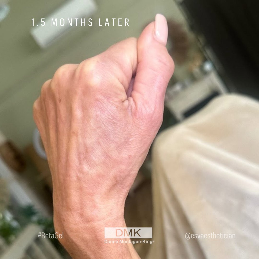 💚 DMK International | Professional Skincare 💚 tweet media