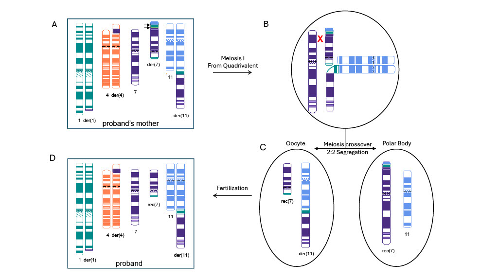 GIMJournal's tweet photo. Complex genomic rearrangement resolved by integrated genomic and cytogenetic approaches, highlighting the power of Hi-C and OGM. #GIMO #ComplexChromosomalRearrangements #HiC #GenomicProximityMapping #GPM #OpticalGenomeMapping #OGM https://t.co/X5A6Exkb74 https://t.co/Ig4lqk9E6W