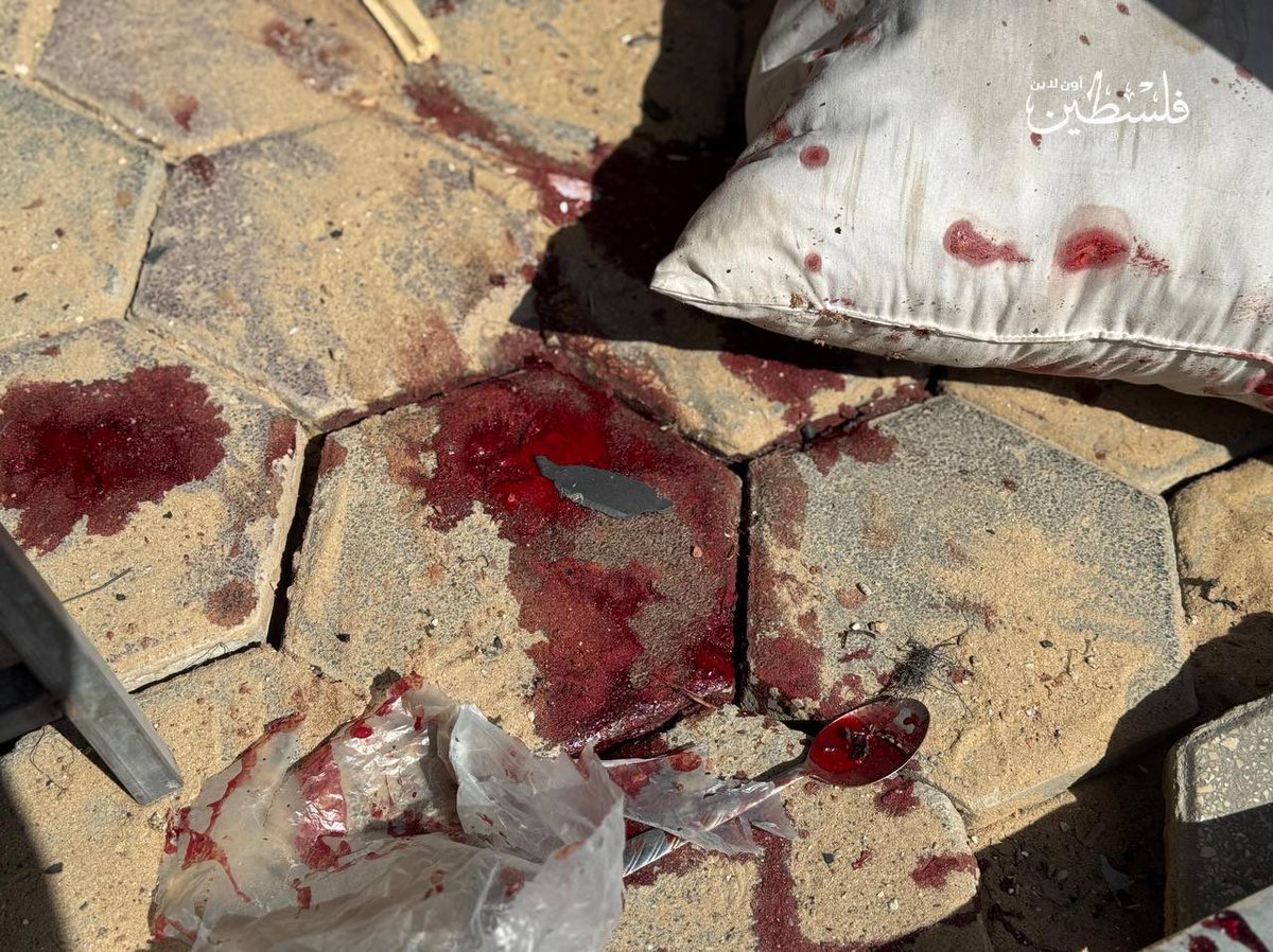 MyPalestine0's tweet photo. إصابات بينها خطيرة في صفوف الكوادر الطبية بعد قصف الاحتلال للبوابة الخلفية لمستشفى الكويت التخصصي بمواصي خانيونس. https://t.co/Rtk9L5hLYt