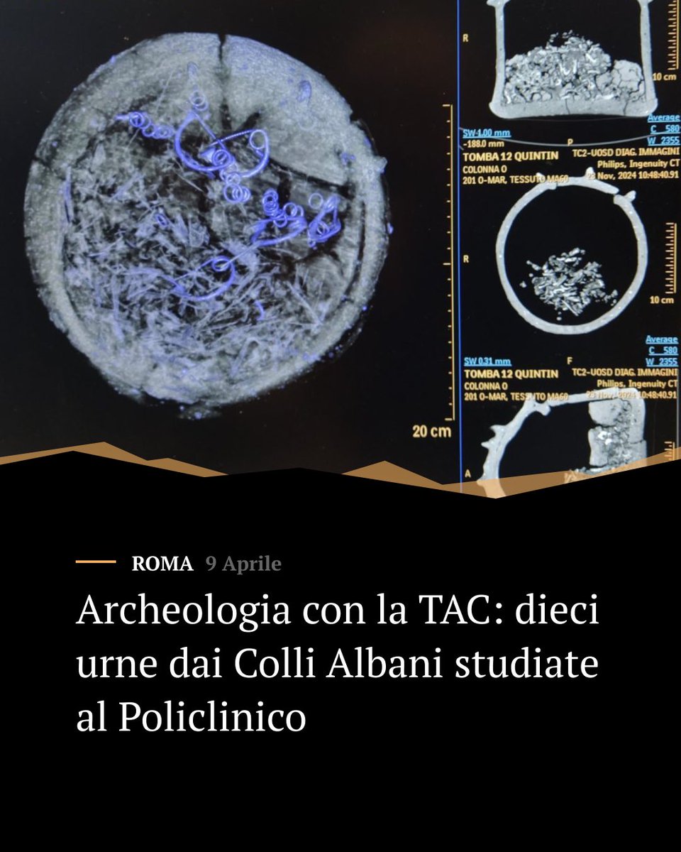 EtruscanTimes's tweet photo. Archeologia con la TAC. Il Policlinico Umberto I di Roma ha avuto oggi in cura dieci pazienti speciali: dieci urne cinerarie databili al X-IX secolo a.C. https://t.co/BEu1vG8VOi

#collialbani #etruschi #etruscans #etrusca #etrusco #archaeology #archeologia #etruscantimes https://t.co/mWnm9ItpeQ