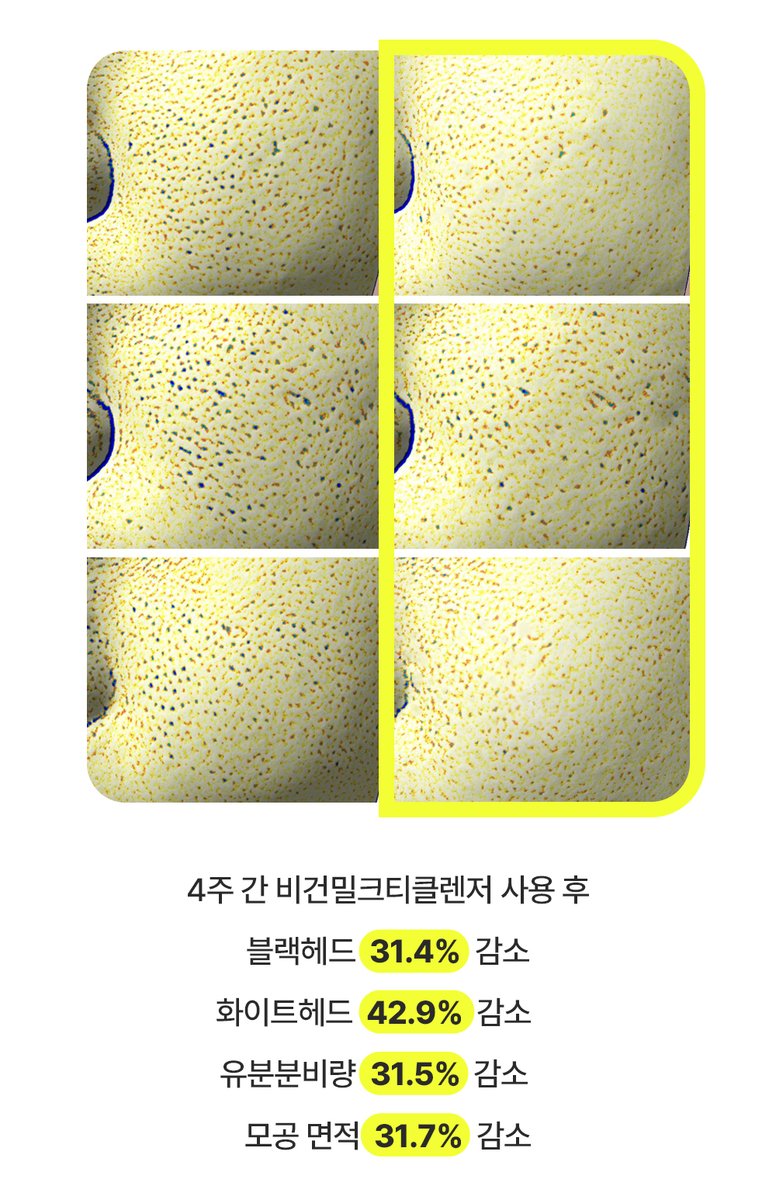 에부리 tweet media