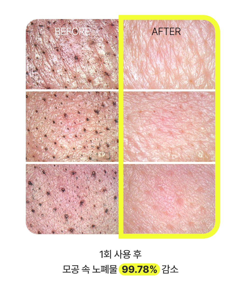 #RT이벤트 #비밀클렌저 
오늘 날씨 덕분에 기분좋음이 상태🌻

요즘 쓰기 딱 좋은 비건 밀크티 클렌저를 
RT해주신 3분께 선물로 드립니다! (당발 4/21)

▫️은은한 밀크티 향 
▪️미세먼지 세정력 99.78%
▫️블랙헤드 &amp; 화이트헤드 모두 개선
▪️선크림 &amp; 메이크업 세정 가능 

더 많은 정보는