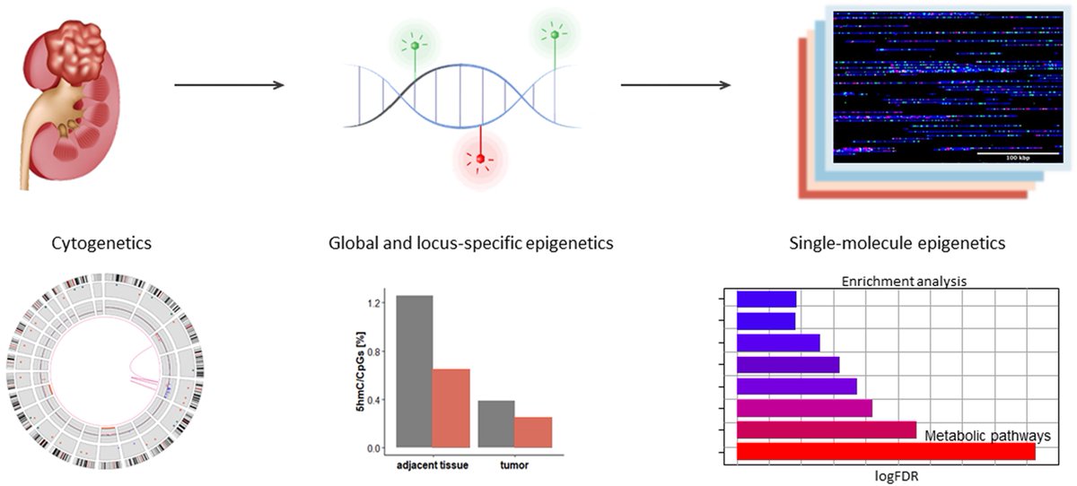 Nucleic Acids Res (@nar_open) on Twitter photo New paper in NAR Cancer uncovers #cancer clues with new mapping approach. "Optical #genome and #epigenome mapping of clear cell #RenalCellCarcinoma". <a href="/SapirM4/">Sapir Margalit</a> <a href="/hagenom/">Yuval Ebenstein</a> #CancerGeneRegulation Read the full article here: doi.org/10.1093/narc... New paper in NAR Cancer uncovers #cancer clues with new mapping approach. "Optical #genome and #epigenome mapping of clear cell #RenalCellCarcinoma". <a href="/SapirM4/">Sapir Margalit</a> <a href="/hagenom/">Yuval Ebenstein</a> #CancerGeneRegulation Read the full article here: doi.org/10.1093/narc...
