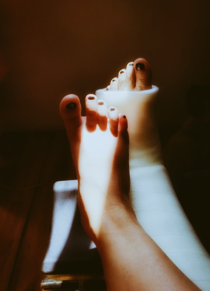Petitemus's tweet photo. Un pequeño secreto bajo el yeso… suave, tentador, reservado para los que saben mirar. A little secret under the cast… soft, tempting, just for you.
#FeetPics #FootInCast #FeetForSale #CastFetish #OnlyFeet #SoftFeet #PiesEnYeso #FeticheDePies #fotosdepies https://t.co/NsdLb03Anc