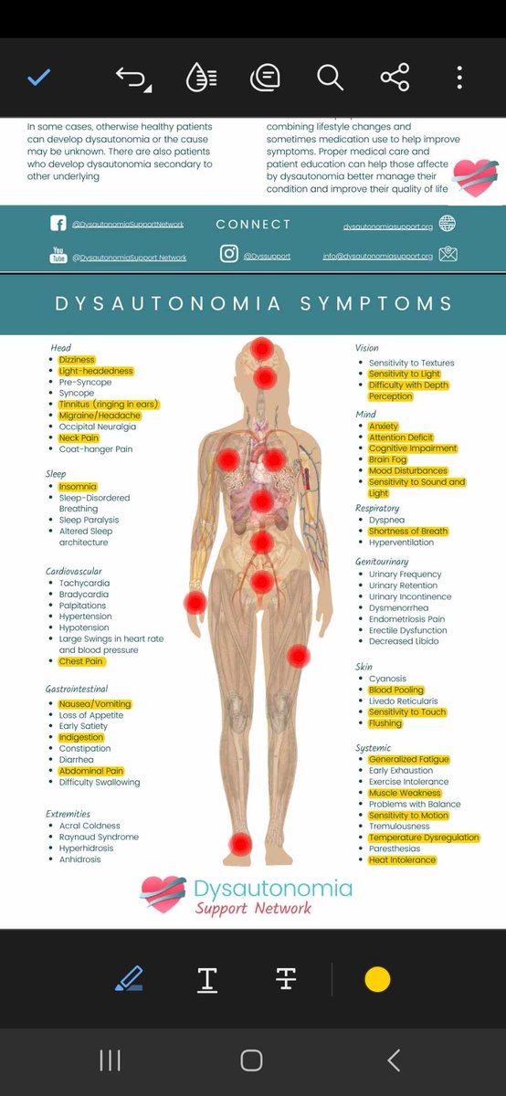 Did 200 laps at Bristol tonight in <a href="/Sim500_Racing/">Sim500 eSports Racing League</a>.  Was going to start and park because I was suffering Dysautonomia symptoms in yellow at the start.  But the race only saw 3 yellows.  I was able to finish 27th 7 laps down, giving cars room while racing sick and slow.