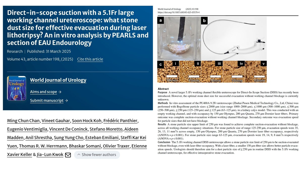 Jia-Lun Kwok (@jl_kwok) on Twitter photo DISS with 5.1Fr WC fURS: What stone size for effective evacuation?
🎯Aim for dust≤250µm
⚡️Size not affected by laser fiber(150/200/270µm)
🚄150µm fiber⏩speed
Article🔗rdcu.be/efTnH
doi.org/10.1007/s00345…
<a href="/OTRAXER/">Olivier Traxer</a> <a href="/endouro/">Prof Bhaskar Somani</a> <a href="/DocGauhar/">DrG</a> <a href="/exkeller/">Etienne Xavier Keller</a> <a href="/steffiyuen/">Steffi Yuen</a> DISS with 5.1Fr WC fURS: What stone size for effective evacuation?
🎯Aim for dust≤250µm
⚡️Size not affected by laser fiber(150/200/270µm)
🚄150µm fiber⏩speed
Article🔗rdcu.be/efTnH
doi.org/10.1007/s00345…
<a href="/OTRAXER/">Olivier Traxer</a> <a href="/endouro/">Prof Bhaskar Somani</a> <a href="/DocGauhar/">DrG</a> <a href="/exkeller/">Etienne Xavier Keller</a> <a href="/steffiyuen/">Steffi Yuen</a>