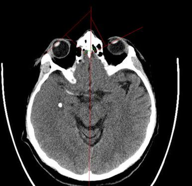 Fred Lepore tweet media