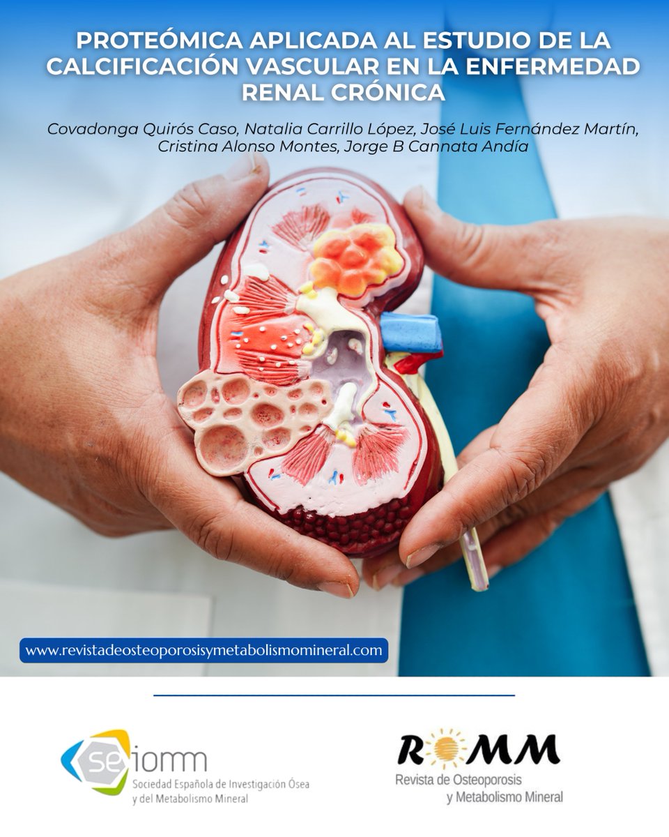 seiomm's tweet image. 🩺🔬 Descubre cómo la calcificación vascular afecta la salud
Un estudio reciente identifica proteínas clave que podrían ser fundamentales para un diagnóstico precoz y mejores estrategias preventivas. 💡
…deosteoporosisymetabolismomineral.com.