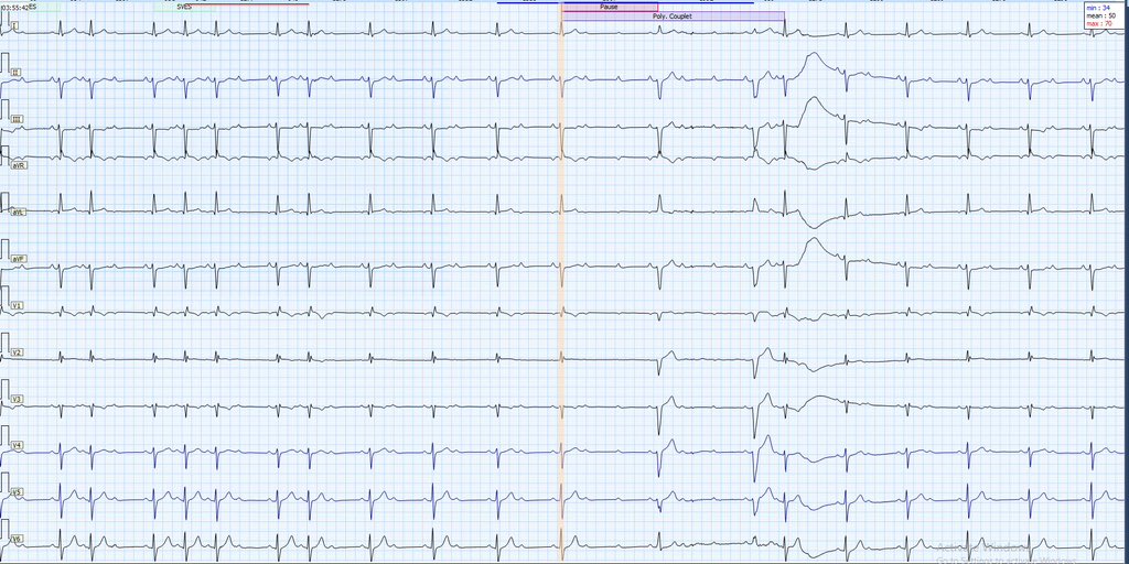 What all we see? #eppeeps #ecg #fellows