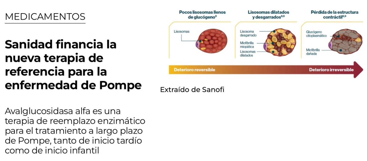 RarasNoInvisibles (@noinvisibles) on Twitter photo Es #DíaMundialPompe #InternationalPompeDay
Ante la #EnfermedaddePompe es necesario un cribado familiar,
porque otros miembros pueden estar afectados al ser hereditaria
Conoce más gracias a👇<a href="/AEEPompe/">AEEPompe - Asociación Española de Enfermos Pompe</a>
asociaciondepompe.org
Desde el año pasado <a href="/sanidadgob/">Ministerio de Sanidad</a> financia tres nuevos Es #DíaMundialPompe #InternationalPompeDay
Ante la #EnfermedaddePompe es necesario un cribado familiar,
porque otros miembros pueden estar afectados al ser hereditaria
Conoce más gracias a👇<a href="/AEEPompe/">AEEPompe - Asociación Española de Enfermos Pompe</a>
asociaciondepompe.org
Desde el año pasado <a href="/sanidadgob/">Ministerio de Sanidad</a> financia tres nuevos