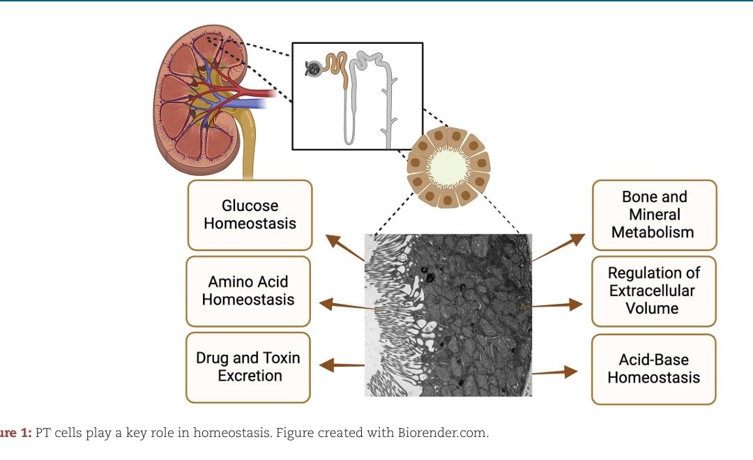 🌀Proximal tubules in health and disease 
✔️ Transport function 
✔️ Endocytosis of filtered protein
✔️ SGLT2i site of action 
✔️ Tubular secretion of various substances 
✔️ Role in kidney injury and repair 

Read in detail - doi.org/10.1093/ndt/gf…
<a href="/NDTsocial/">NDT</a>

#Nephrology