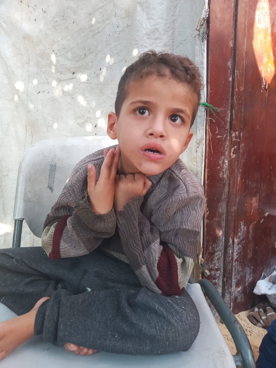 em_mustafa1's tweet image. This is my son Yamen, he is 6 yo and has a brain atrophy that constantly needs treatment.After a year and a half of war,I can no longer provide him with treatment. I am in a dire need of your help to provide him with treatment.
chuffed.org/project/128147โฆ
@Louis_Allday @IbnRiad