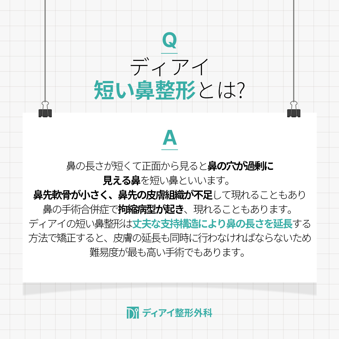 diprsjp's tweet photo. 鼻が短くてイメージ変身がお悩みの方に注目！

まず、鼻の長さはどこから始まりますか？
鼻柱が出発する目と目の間の鼻の
最も低い地点から鼻先の下までの長さを意味！
したがって、短い鼻は鼻筋の最初から鼻先までの長さが短い場合は短い鼻に該当します

短い鼻の2つのタイプ
1. 鼻柱の始点が低い場合
2. 鼻筋は適切なのに鼻先がつまった場合（らっぱ鼻）

このように鼻が短い場合、鼻が適切な顔面比率から外れて小さい場合が多いです。
また、鼻の穴が多く見えるインソール鼻の形をした短い鼻は
洗練された感じとは距離があって矯正を希望される方が多いです。
鼻先と鼻柱の形と角度は理想的ですが、鼻柱の始点だけ低い場合は
鼻を高くするプロテーゼを入れるだけで簡単に矯正できます。

でも、鼻先が聞こえてできた短い鼻は、矯正の過程がもっと複雑なんです。
鼻の先の方向と骨格を決定する構造物は、鼻と鼻の先の部分を
構成する両側の下外側の軟骨とその中央の中心を握る比重格で構成されています。
鼻先の構造が小さかったり、上に持ち上げられたりすると、短い鼻になります。
したがって、解決策はこの構造を前方に拡大強化させ
持ち上がった軟骨を下の前の方に再配置させるのです。

ディーアイ整形外科では、これらの点をすべて考慮し
患者一人一人の特性と要求事項に合わせたオーダーメイド型短鼻成形をしています。
正確な診断と精密な手術設計、熟練した医療スタッフの執刀、体系的な手術後の管理により
満足のいく結果をお届けしています。

@574lbeop  https://t.co/YpKlZ5bLE2

 #韓国整形外科 #韓国鼻整形 #韓国整形 #韓国鼻手術 #韓国整形情報 #韓国整形症例 #鼻整形症例 #韓国鼻整形症例 #鼻フル #団子鼻 #短い鼻 #自己肋軟骨 #鼻肋軟骨 #肋軟骨手術 #鼻手術 #鼻整形 #鼻再手術 #ハンプ手術 #ハンプ鼻 #ハンプ鼻手術 #鼻整形 #韓国鼻整形 #プロテーゼ #鼻中隔延長 #韓国鼻整形おすすめ #韓国整形外科おすすめ #韓国整形外科 #DI整形外科