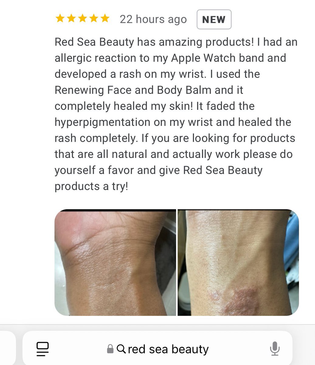 RedSeaBeauty's tweet photo. Our balm is naturally antibacterial and heals all skin irritations. 

https://t.co/u23bIKHkux https://t.co/DDQ5dQGxLB