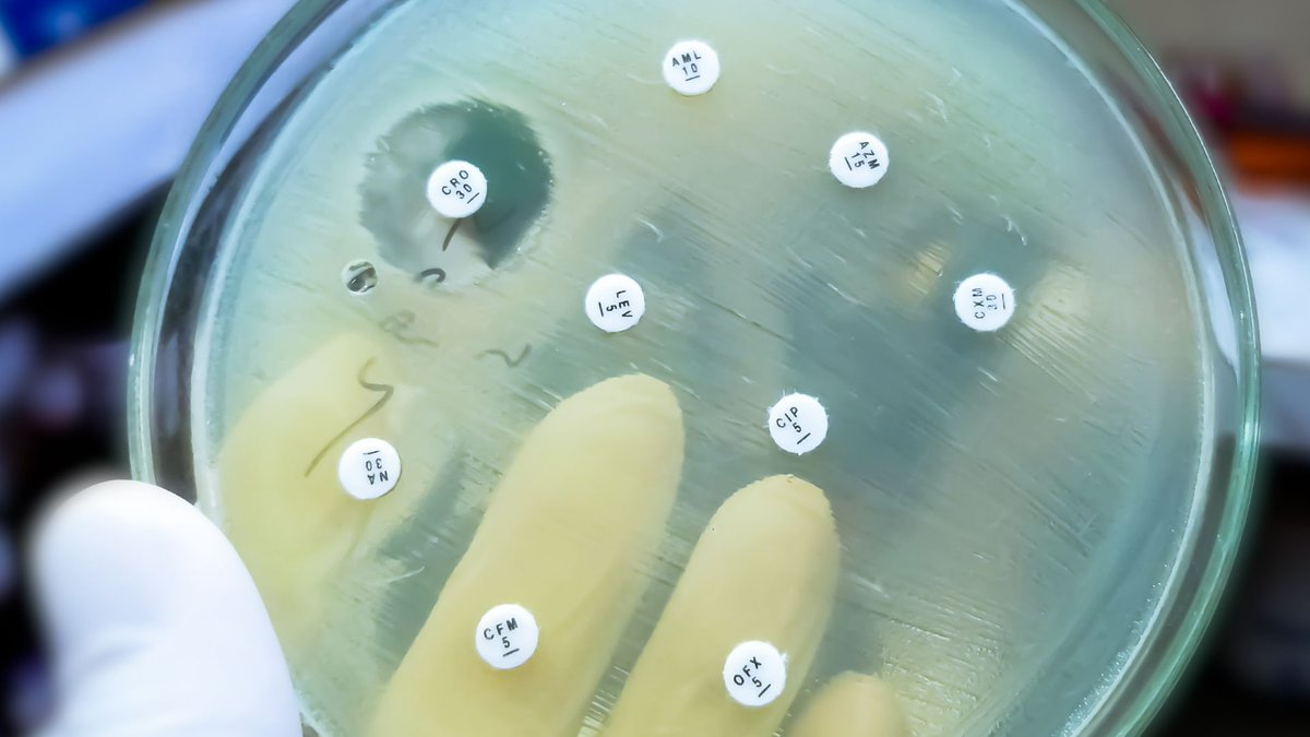 Kraken Sense (@krakensense) on Twitter photo Antimicrobial resistance (AMR) threatens patient safety, increasing hospital stays, costs, and mortality.
Stay ahead of AMR with real-time monitoring: buff.ly/40VShsI
#HealthcareSafety #InfectionControl #AMRPrevention #Innovation Antimicrobial resistance (AMR) threatens patient safety, increasing hospital stays, costs, and mortality.
Stay ahead of AMR with real-time monitoring: buff.ly/40VShsI
#HealthcareSafety #InfectionControl #AMRPrevention #Innovation