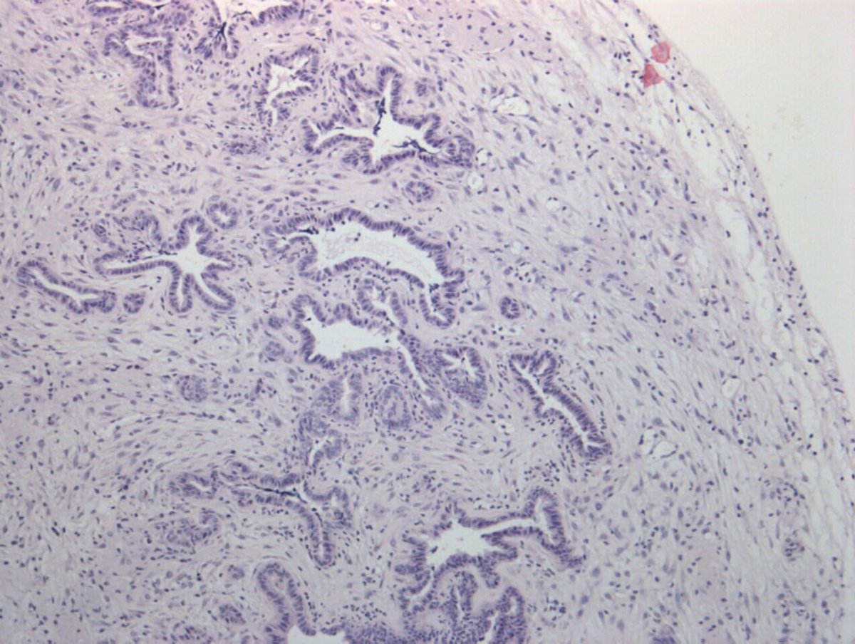 Hospital del Mar (@hospitaldelmar) on Twitter photo Identifiquen una de les claus de l’alta agressivitat del #càncerdepàncrees
Estudi del <a href="/PNavarro_Lab/">Pilar Navarro Lab</a>, <a href="/HMar_research/">HMar Research Institute</a>, publicat a <a href="/PNASNews/">PNASNews</a>
#fibroblasts #proteïna <a href="/iibbcsic/">IIBB - CSIC</a> <a href="/CSIC/">CSIC</a> <a href="/FundlaCaixa/">Fundación ”la Caixa”</a> <a href="/gabyrabi/">Gabriel Rabinovich</a> <a href="/MayoClinic/">Mayo Clinic</a> <a href="/CaixaResearch/">CaixaResearch</a>
hospitaldelmar.cat/ca/noticies/vi… Identifiquen una de les claus de l’alta agressivitat del #càncerdepàncrees
Estudi del <a href="/PNavarro_Lab/">Pilar Navarro Lab</a>, <a href="/HMar_research/">HMar Research Institute</a>, publicat a <a href="/PNASNews/">PNASNews</a>
#fibroblasts #proteïna <a href="/iibbcsic/">IIBB - CSIC</a> <a href="/CSIC/">CSIC</a> <a href="/FundlaCaixa/">Fundación ”la Caixa”</a> <a href="/gabyrabi/">Gabriel Rabinovich</a> <a href="/MayoClinic/">Mayo Clinic</a> <a href="/CaixaResearch/">CaixaResearch</a>
hospitaldelmar.cat/ca/noticies/vi…