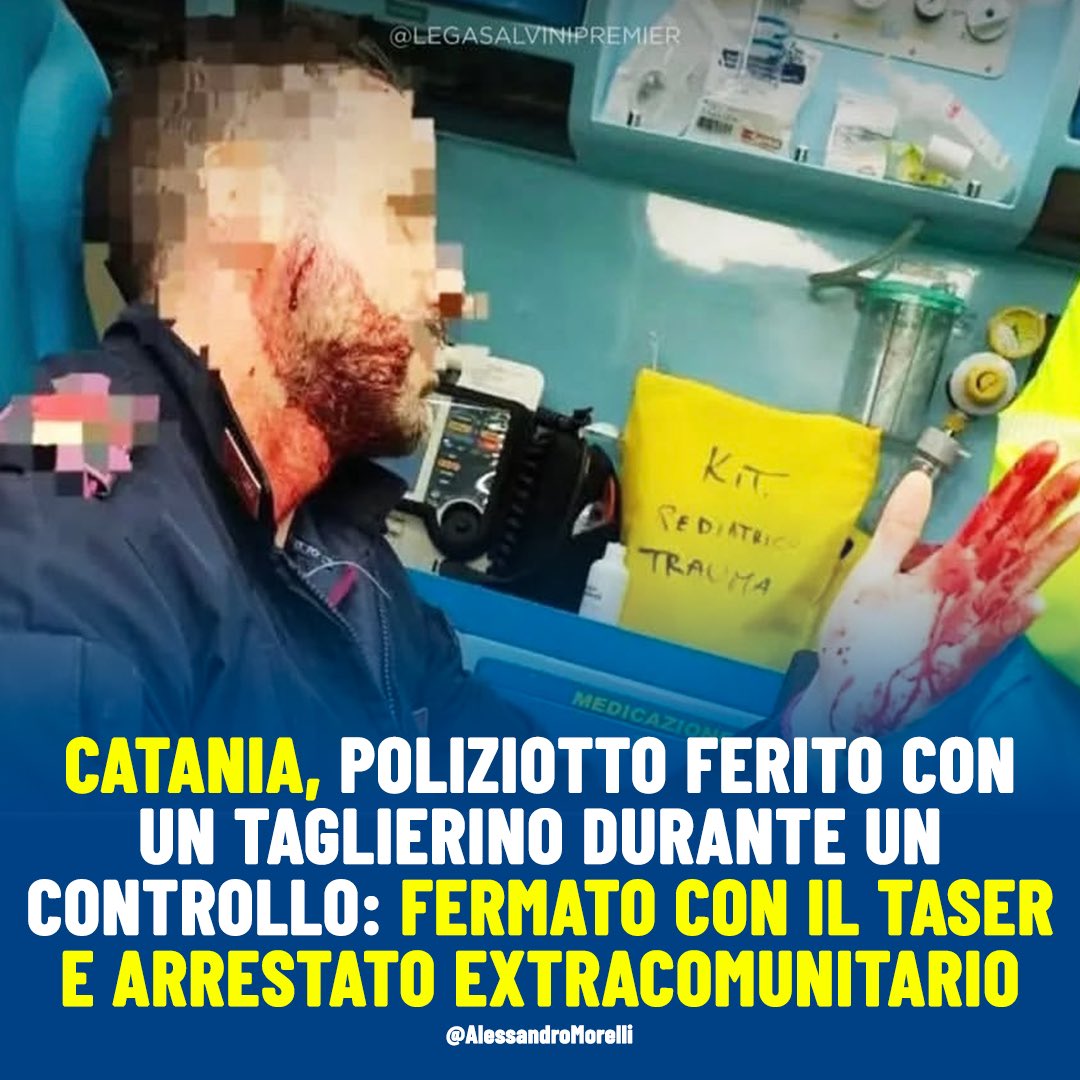 A Catania, un extracomunitario fermato per un normale controllo ha improvvisamente aggredito un poliziotto con un taglierino, ferendolo al volto. L’agente è stato trasportato in ospedale, dove ha ricevuto cinque punti di sutura e una prognosi di sette giorni.
L’aggressore è stato